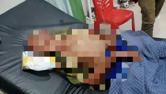 Dua Hari Hilang, Kakek di Kupang Ditemukan Selamat dengan Kepala Terjebak di Lubang Batu